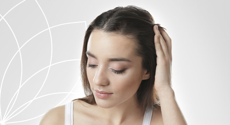 Alopecia Areata Imagem Alopecia Areata