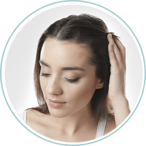 Imagem Alopecia Areata